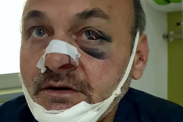 Prosecution has still not initiated a procedure for the physical attack on Petrovski